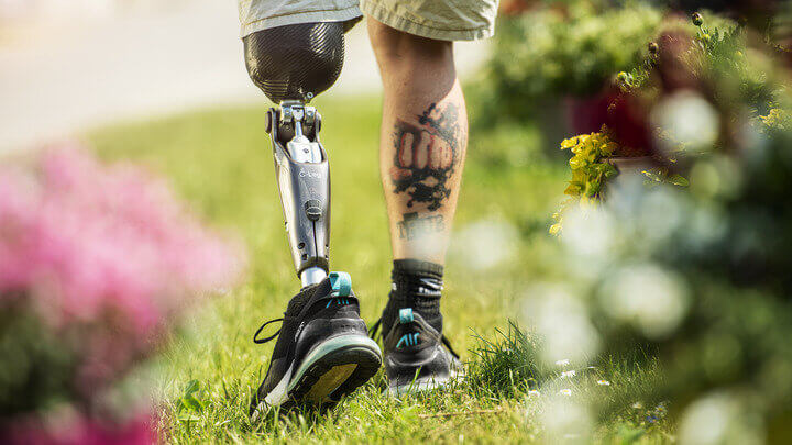 Ottobock C-Leg 4 Biyonik Protez Bacak